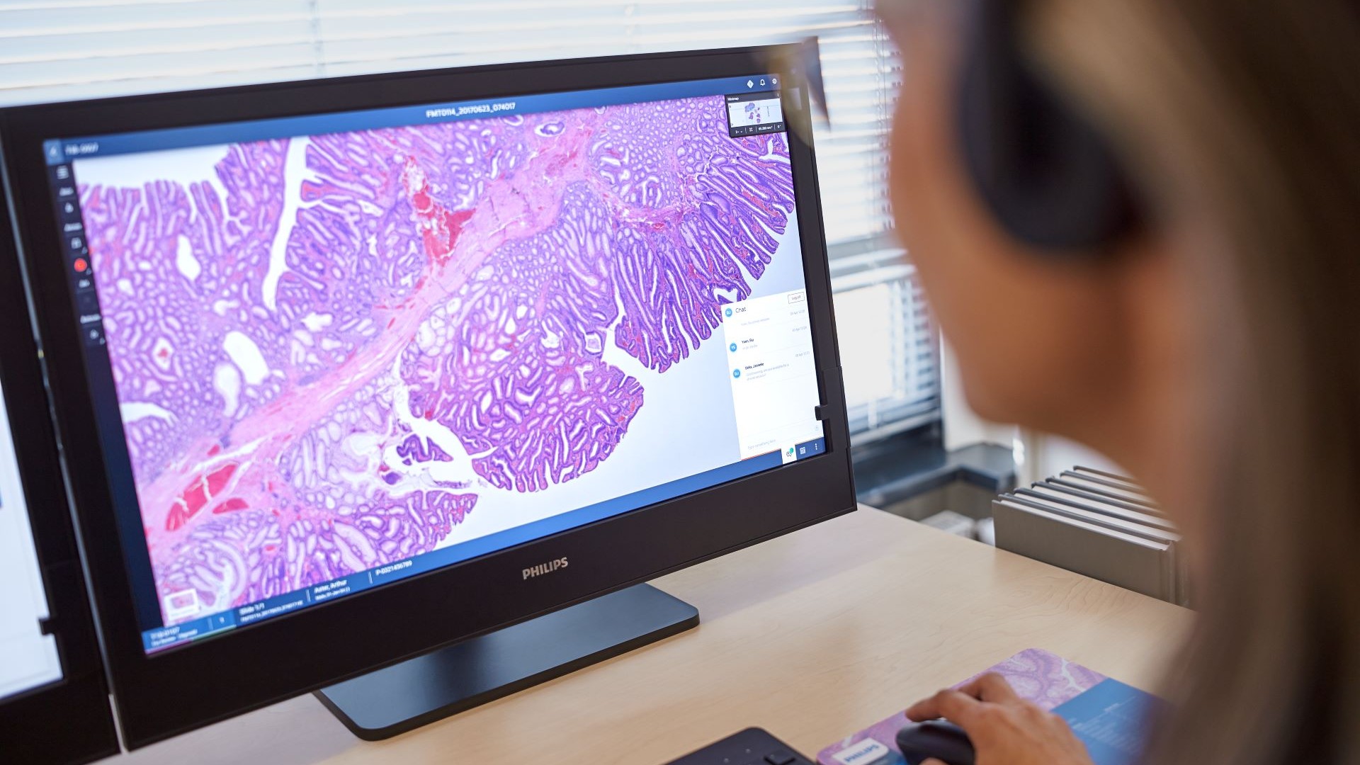 Philips and Histolab Launch Strategic Partnership to Enhance Digital Pathology Solutions Across the Nordics 